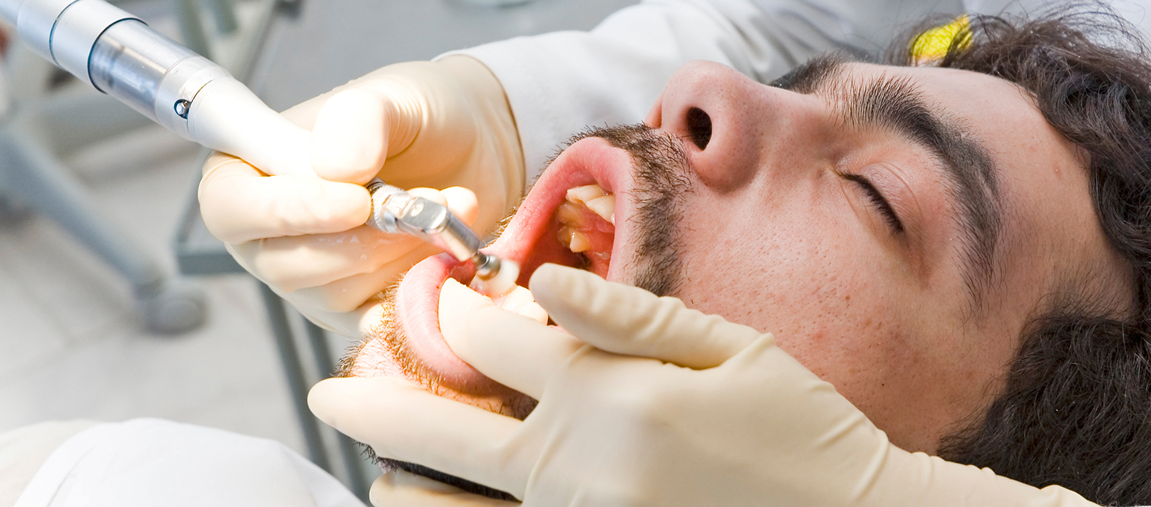 teeth whitening