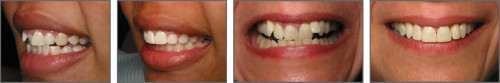 6 month smiles